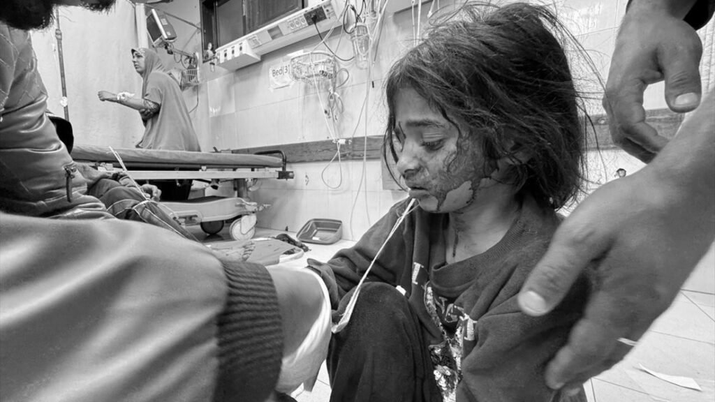 Более 64 тысяч детей в Газе погибли или получили ранения в результате израильских атак- ЮНИСЕФ